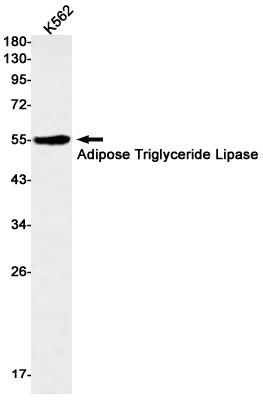 Anti-Adipose Triglyceride Lipase Rabbit Monoclonal Antibody