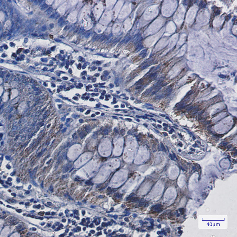 Anti-Adrenodoxin Rabbit Monoclonal Antibody