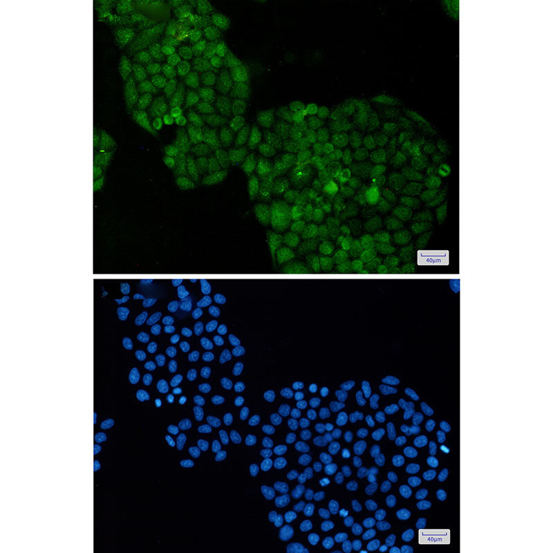 Anti-ADRM1 Rabbit Monoclonal Antibody