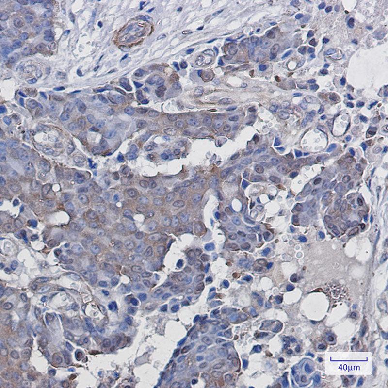 Anti-ADRM1 Rabbit Monoclonal Antibody