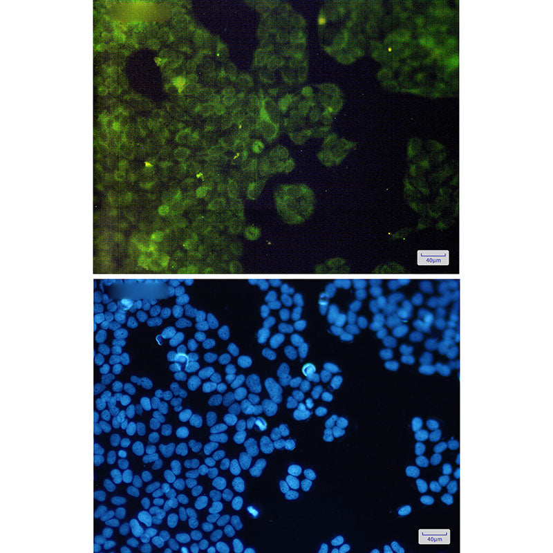 Anti-AdSS 2 Rabbit Monoclonal Antibody