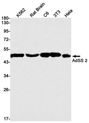 Anti-AdSS 2 Rabbit Monoclonal Antibody