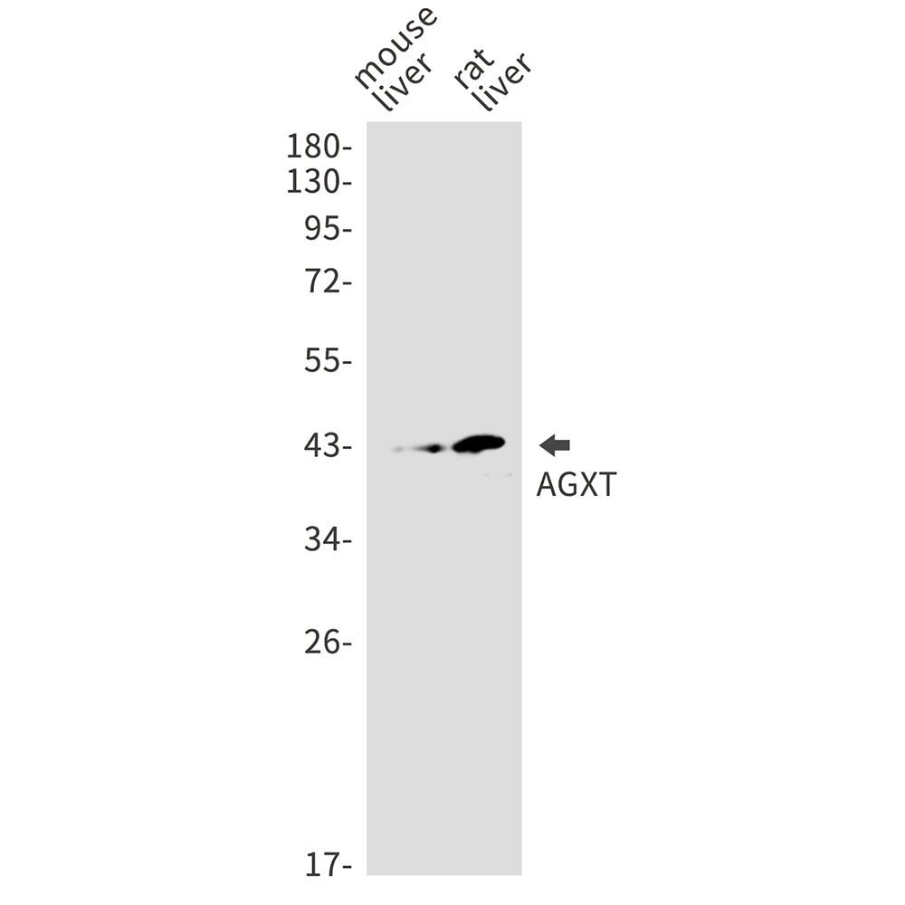 Anti-AGXT Rabbit Monoclonal Antibody