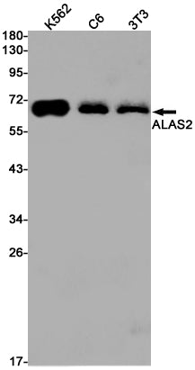 Anti-ALAS2 Rabbit Monoclonal Antibody