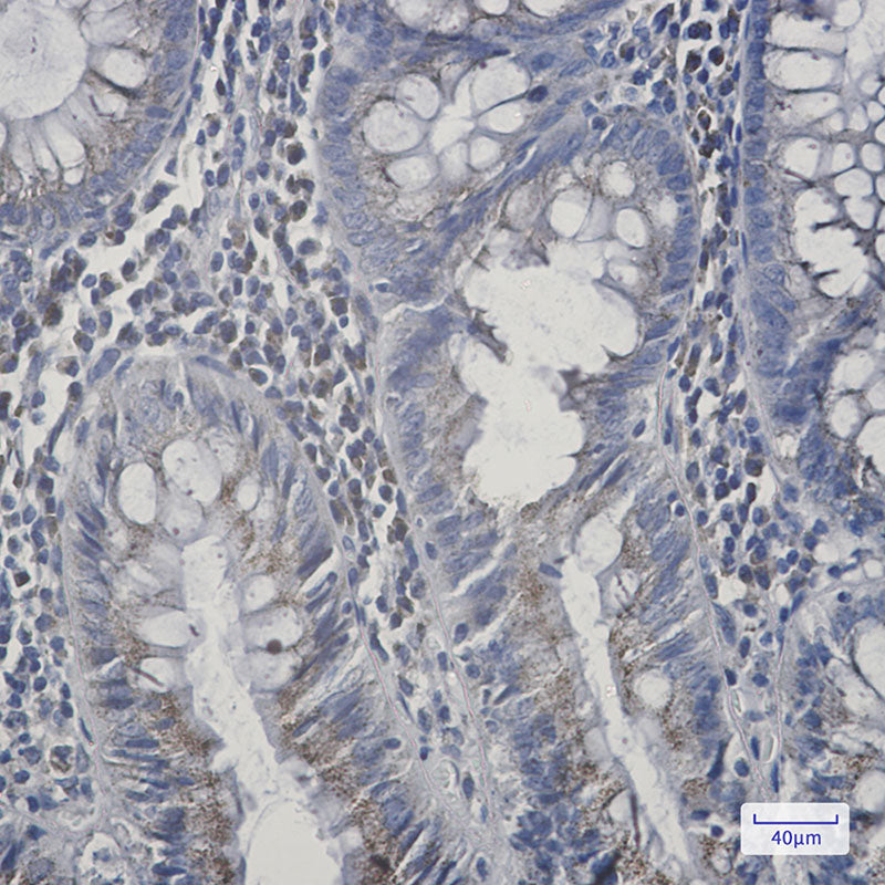 Anti-AGPS Rabbit Monoclonal Antibody