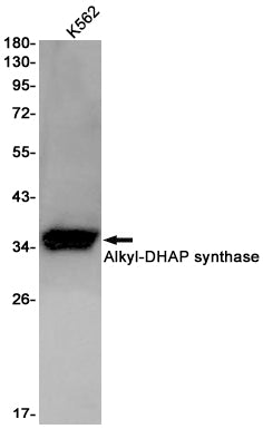Anti-AGPS Rabbit Monoclonal Antibody