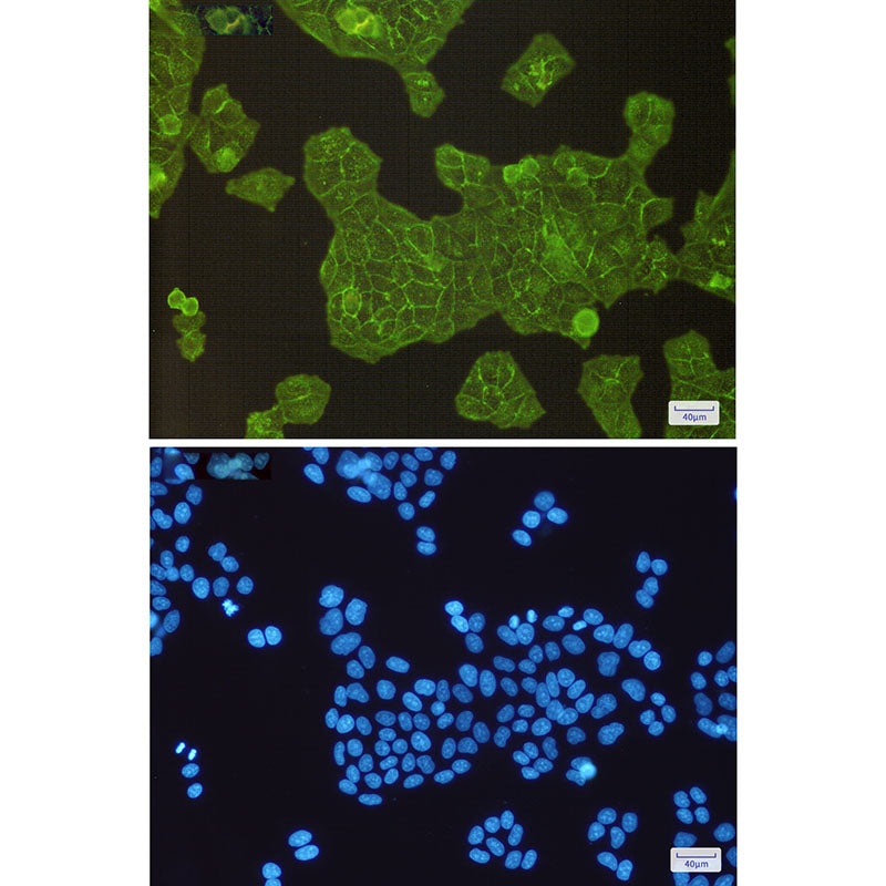 Anti-alpha Actinin 4 Rabbit Monoclonal Antibody