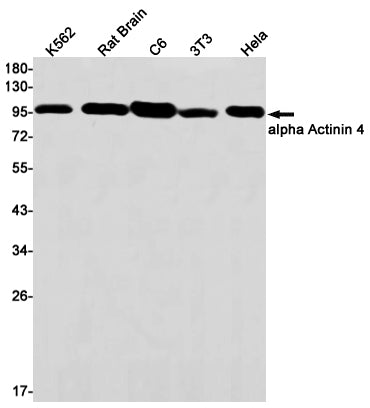 Anti-alpha Actinin 4 Rabbit Monoclonal Antibody