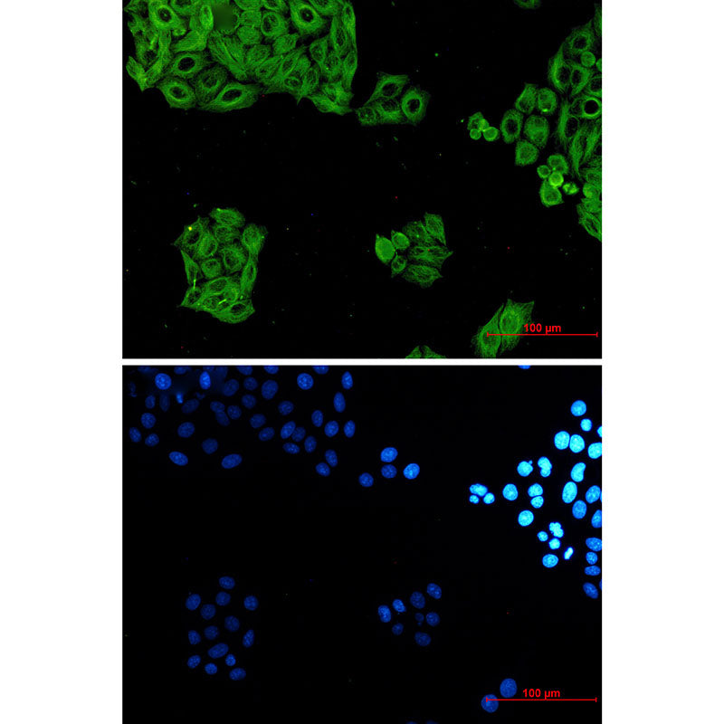 Anti-alpha Tubulin Rabbit Monoclonal Antibody