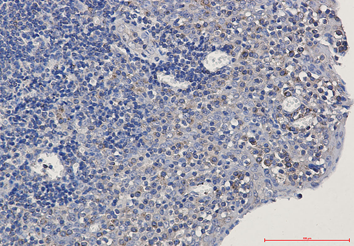 Anti-alpha Tubulin Rabbit Monoclonal Antibody