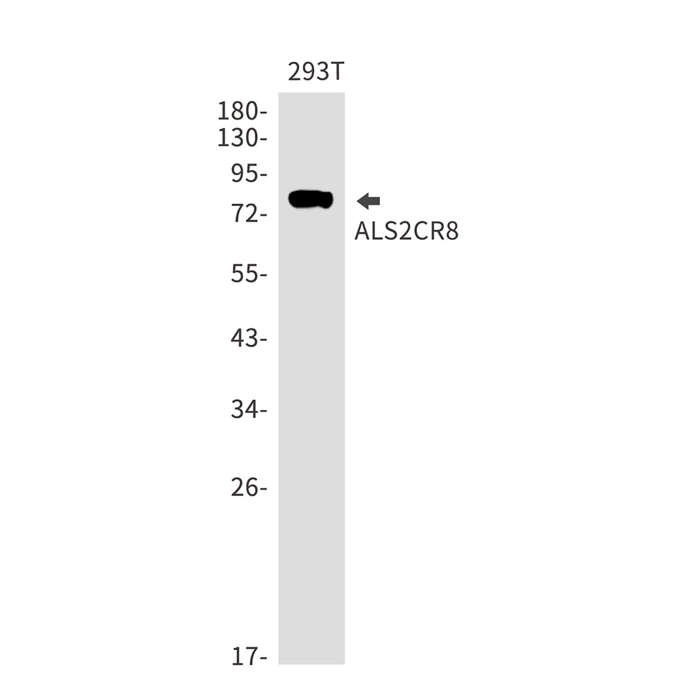 Anti-ALS2CR8 Rabbit Monoclonal Antibody