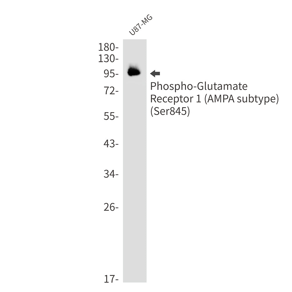 Anti-Phospho-Glutamate Receptor 1 (AMPA Subtype) (Ser845) Rabbit Monoclonal Antibody