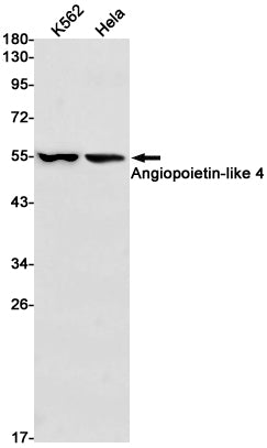 Anti-Angiopoietin Like 4 Rabbit Monoclonal Antibody