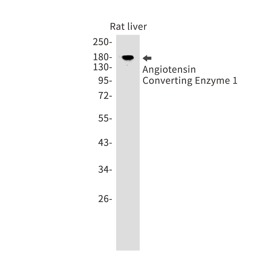 Anti-Angiotensin Converting Enzyme 1 Rabbit Monoclonal Antibody