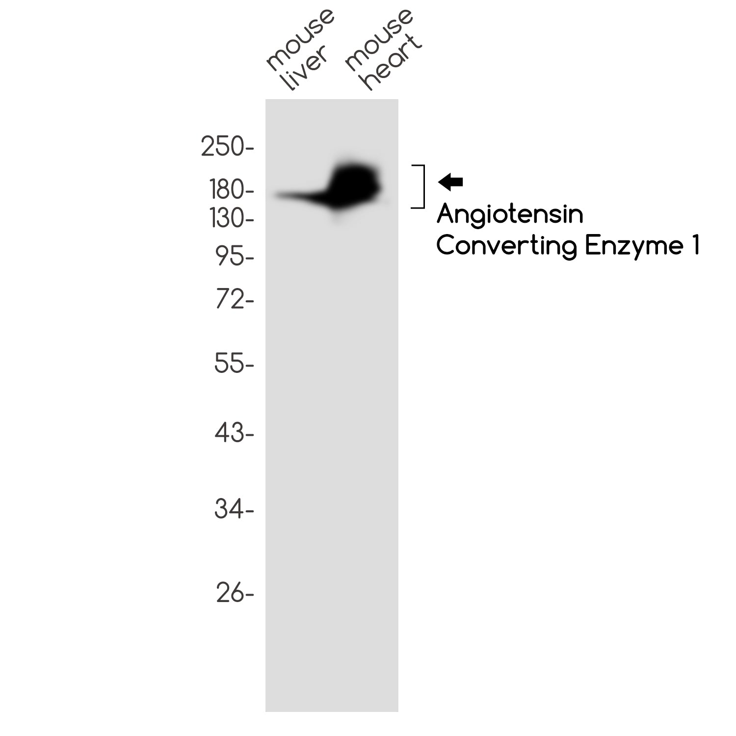 Anti-Angiotensin Converting Enzyme 1 Rabbit Monoclonal Antibody