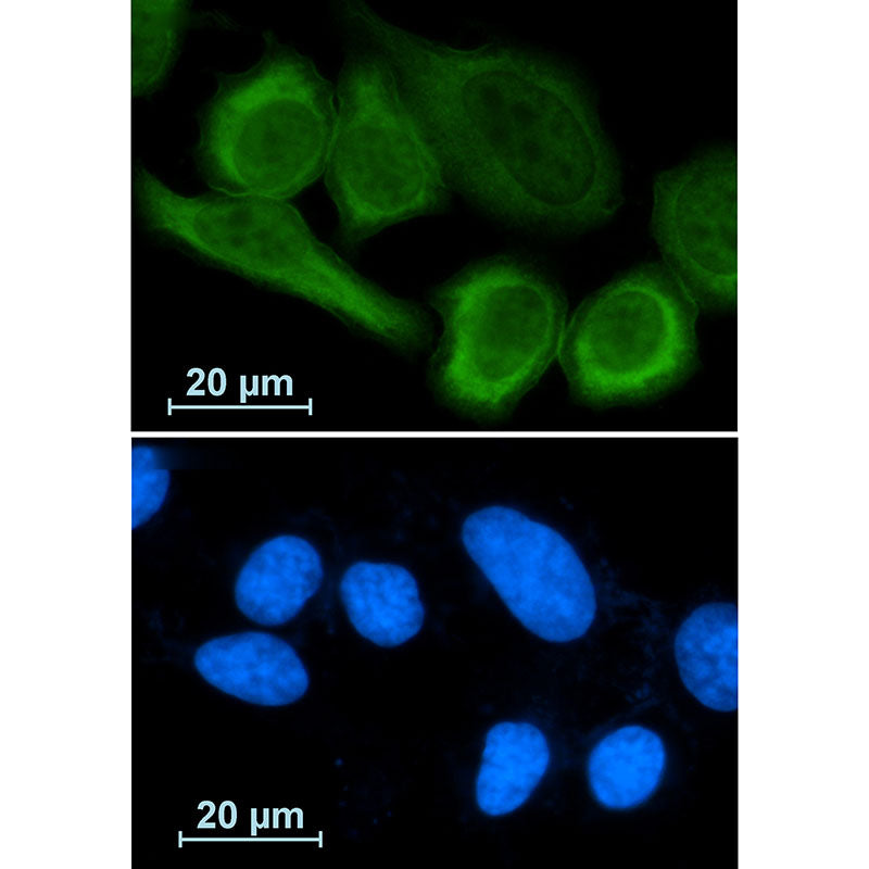 Anti-Annexin A1 Rabbit Monoclonal Antibody