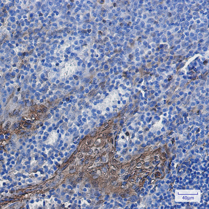 Anti-Annexin A1 Rabbit Monoclonal Antibody