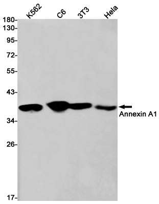 Anti-Annexin A1 Rabbit Monoclonal Antibody