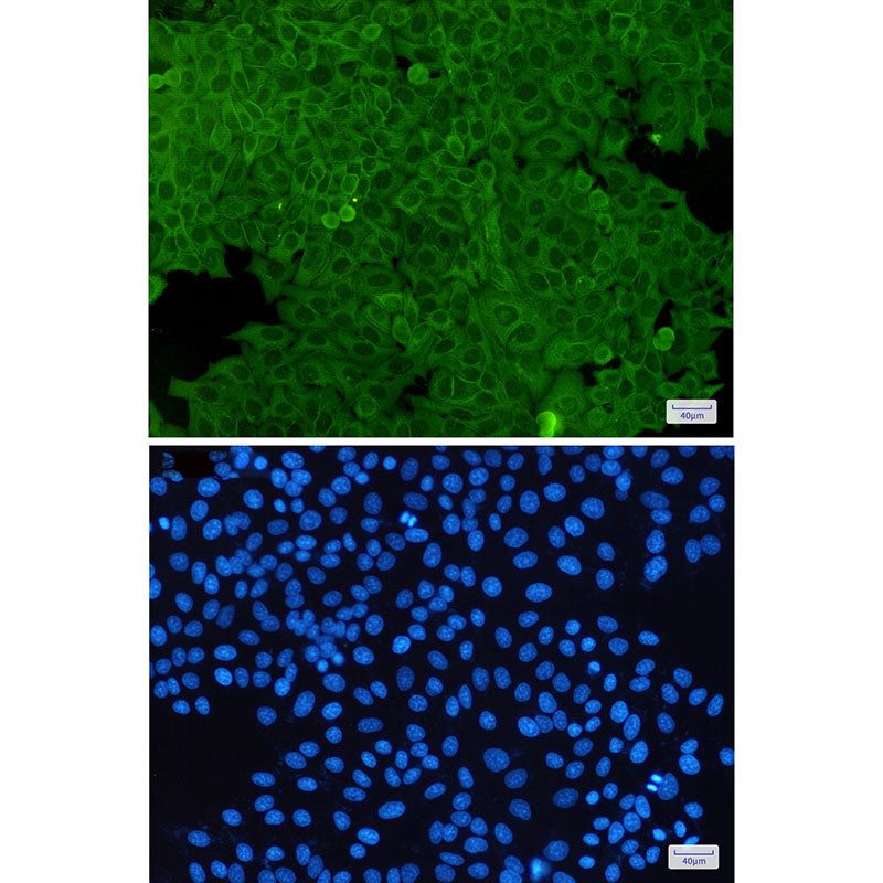 Anti-Annexin A2 Rabbit Monoclonal Antibody