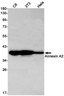 Anti-Annexin A2 Rabbit Monoclonal Antibody