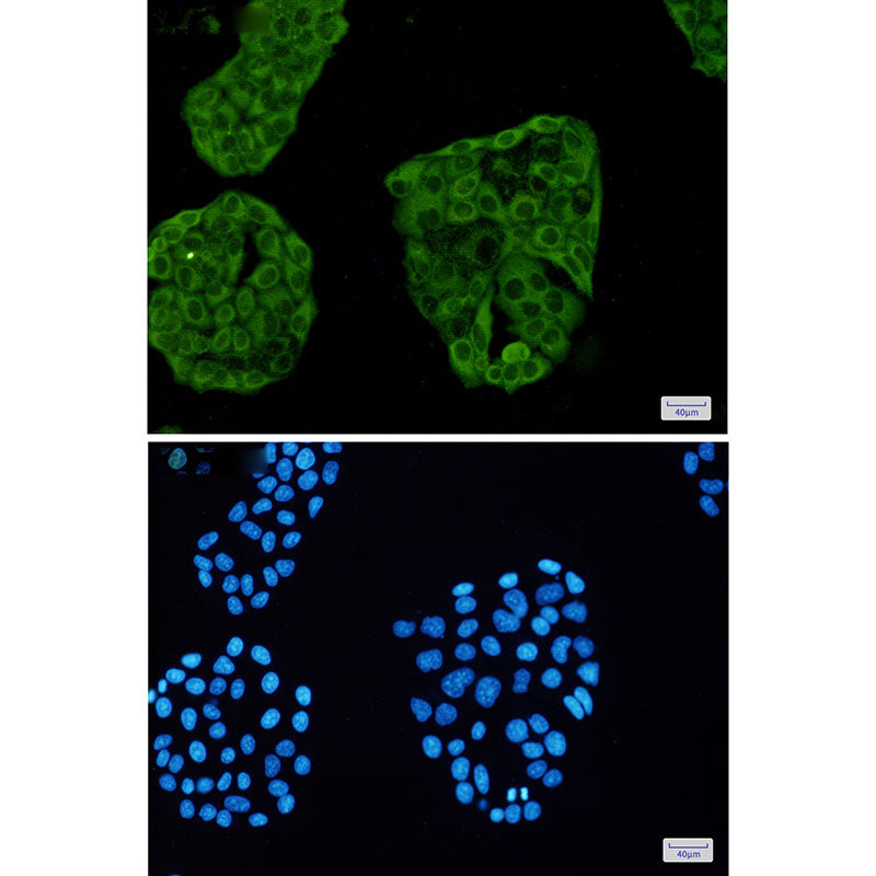 Anti-Annexin VI Rabbit Monoclonal Antibody