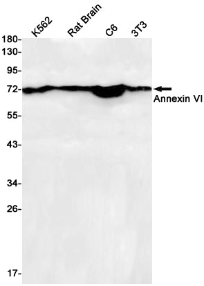 Anti-Annexin VI Rabbit Monoclonal Antibody