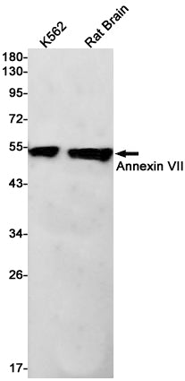 Anti-Annexin VII Rabbit Monoclonal Antibody