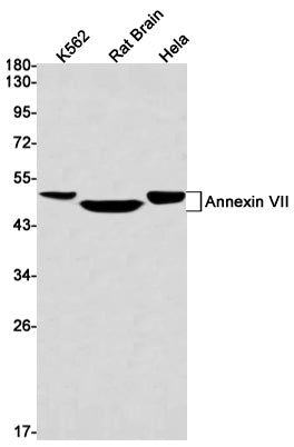 Anti-Annexin VII Rabbit Monoclonal Antibody