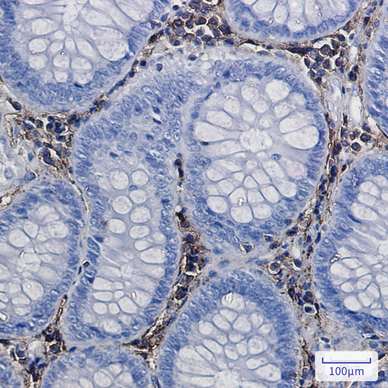 Anti-Annexin VI Rabbit Monoclonal Antibody