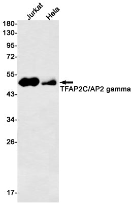 Anti-Transcription Factor AP 2 gamma Rabbit Monoclonal Antibody