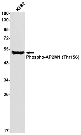 Anti-Phospho-AP2M1 (Thr156) Rabbit Monoclonal Antibody