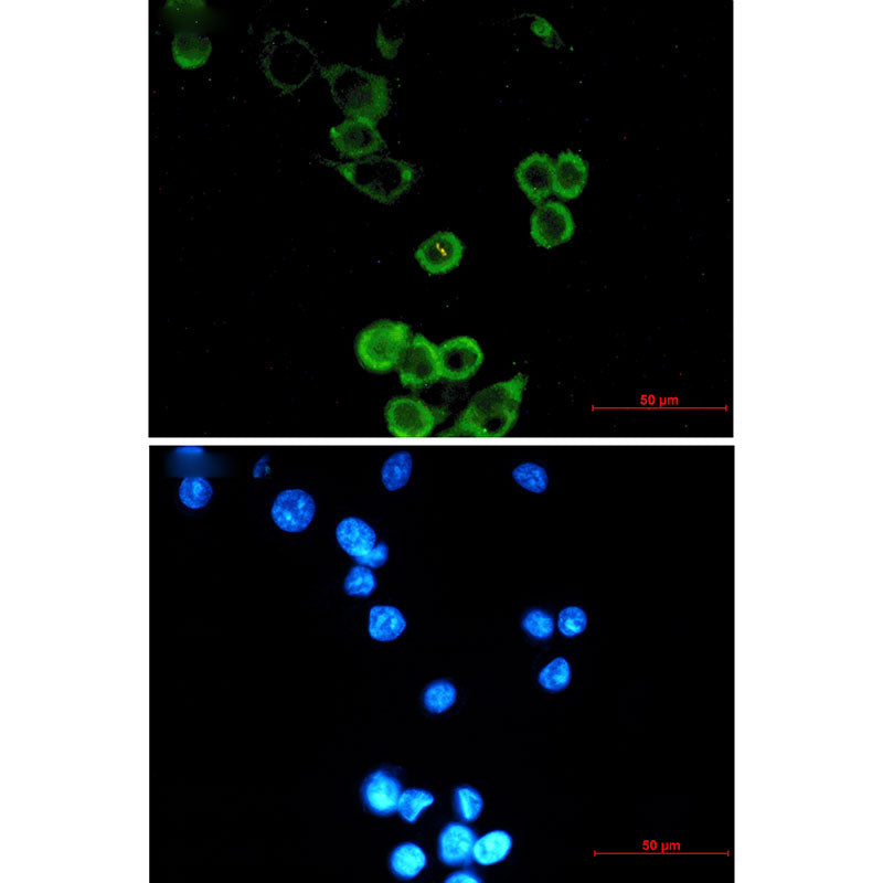 Anti-APG5L Rabbit Monoclonal Antibody