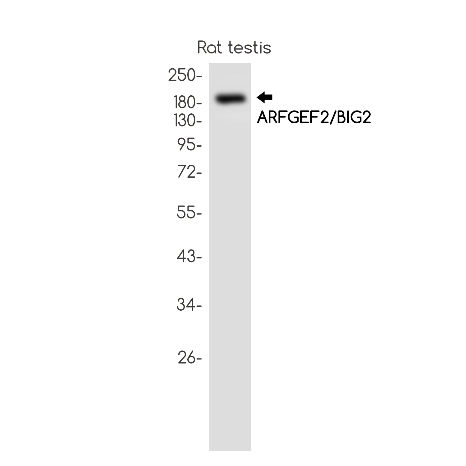 Anti-ARFGEF2 Rabbit Monoclonal Antibody
