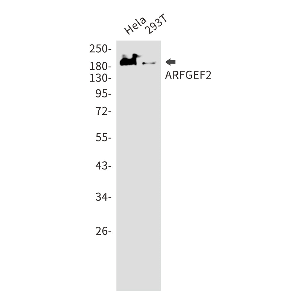 Anti-ARFGEF2 Rabbit Monoclonal Antibody