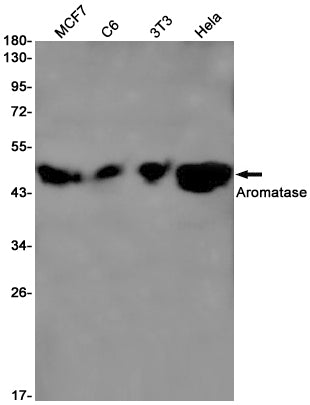 Anti-Aromatase Rabbit Monoclonal Antibody