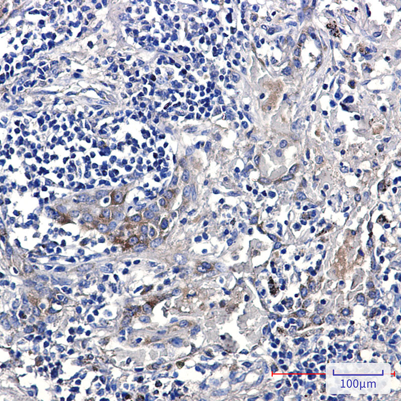 Anti-ERAP1 Rabbit Monoclonal Antibody