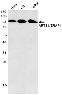Anti-ERAP1 Rabbit Monoclonal Antibody