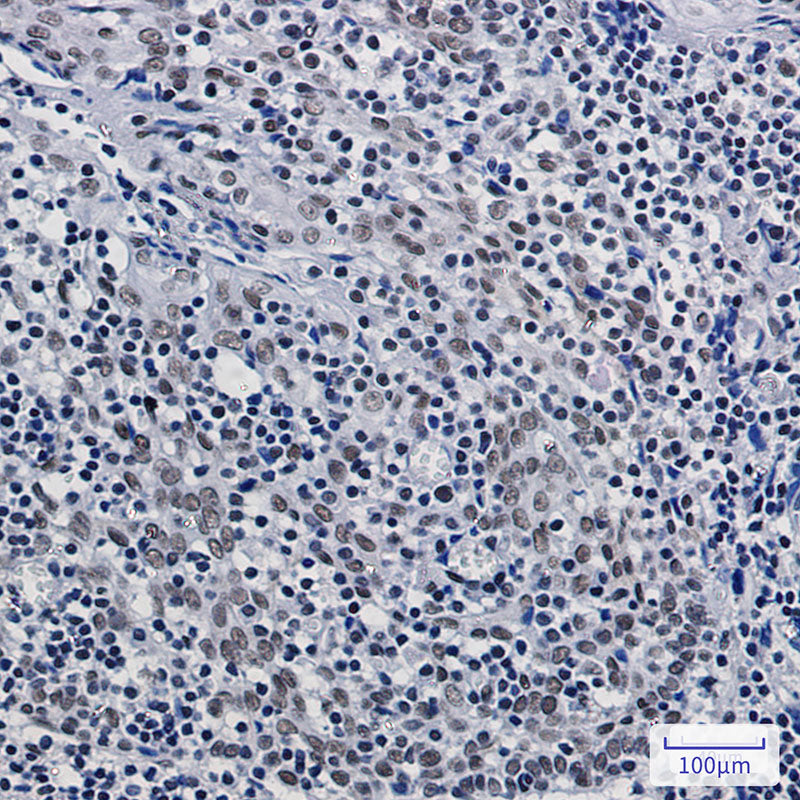 Anti-ASH2L Rabbit Monoclonal Antibody