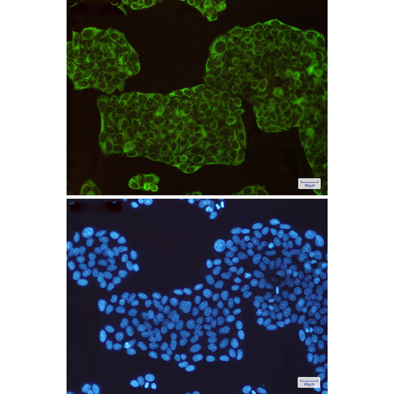 Anti-ASS1 Rabbit Monoclonal Antibody