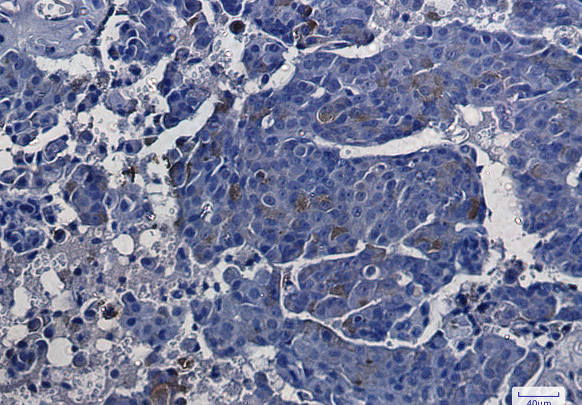Anti-ASS1 Rabbit Monoclonal Antibody