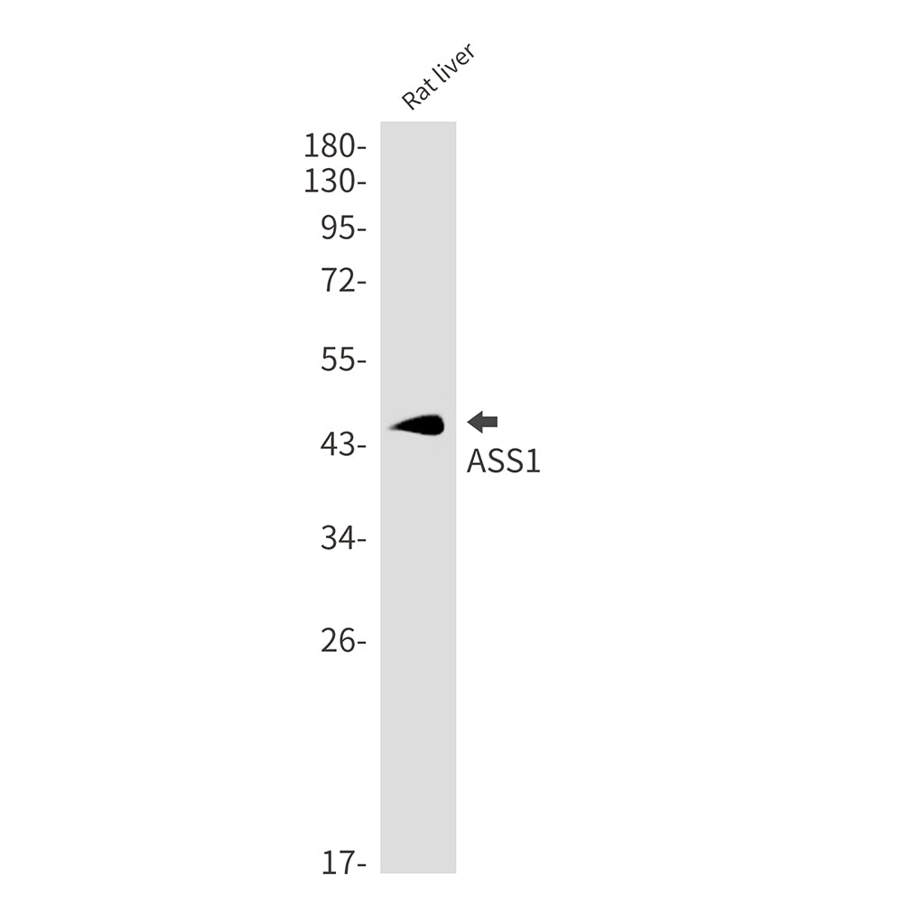 Anti-ASS1 Rabbit Monoclonal Antibody