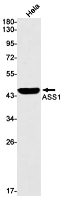 Anti-ASS1 Rabbit Monoclonal Antibody