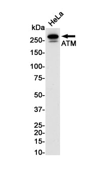 Anti-ATM Rabbit Monoclonal Antibody