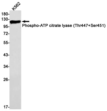 Anti-Phospho-ATP Citrate Synthase (Thr447/Ser451) Rabbit Monoclonal Antibody