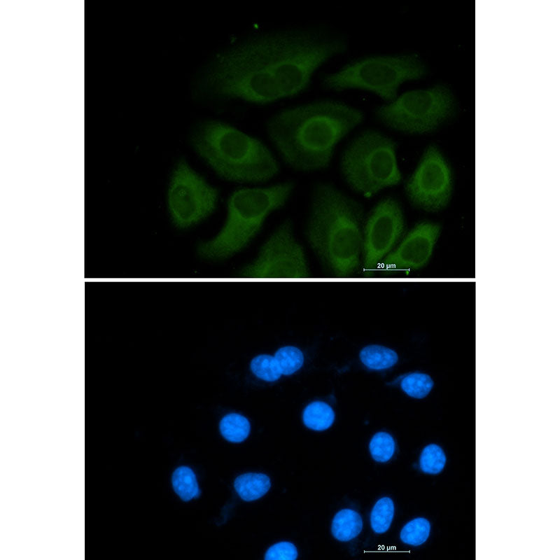 Anti-ATP Citrate lyase Rabbit Monoclonal Antibody