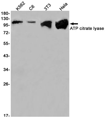 Anti-ATP Citrate lyase Rabbit Monoclonal Antibody