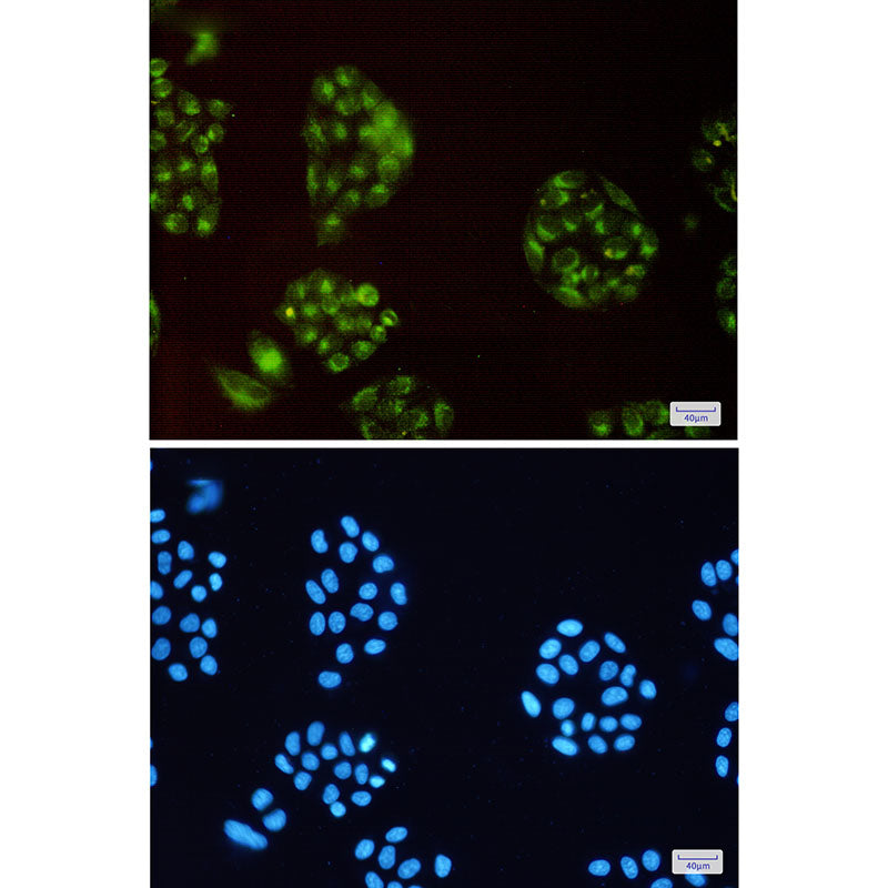 Anti-ATP6V0D1 Rabbit Monoclonal Antibody