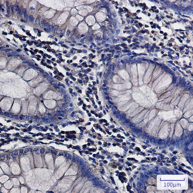 Anti-ATP6V0D1 Rabbit Monoclonal Antibody