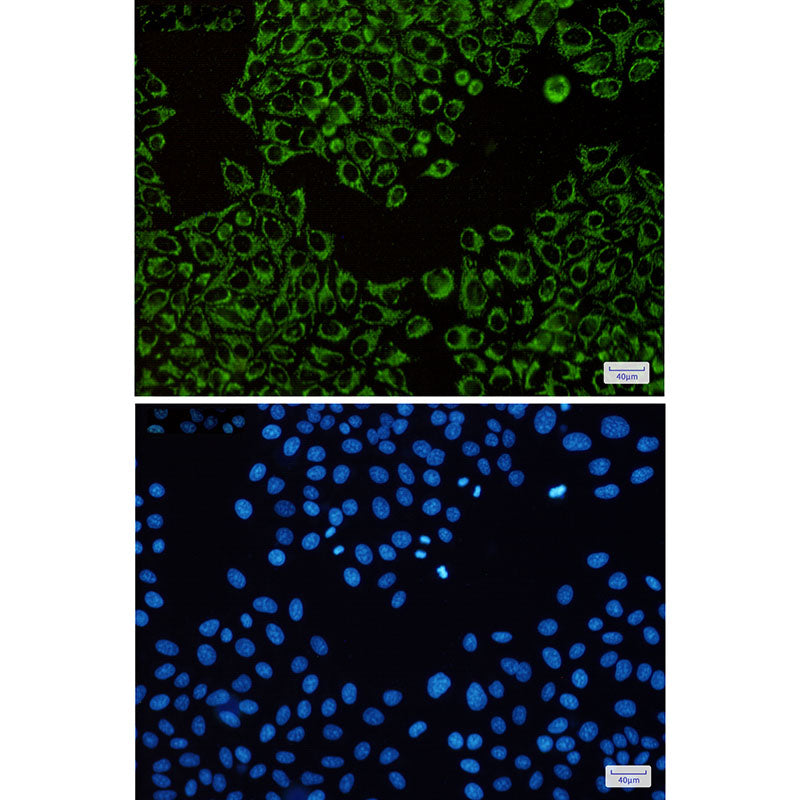 Anti-ATPB Rabbit Monoclonal Antibody