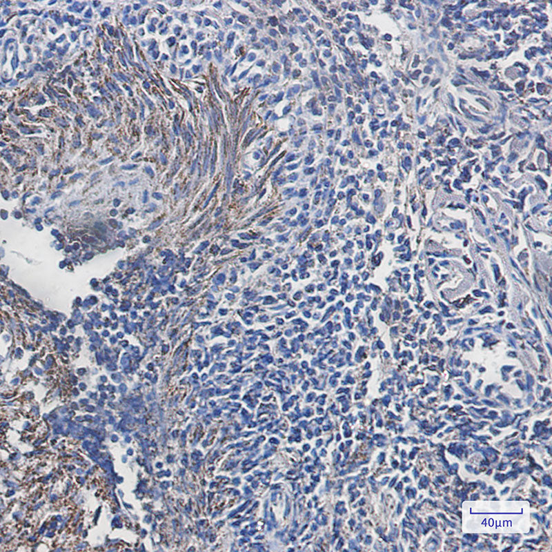 Anti-ATPB Rabbit Monoclonal Antibody